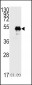 p53 Antibody (T55)